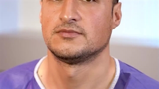 «نمونه کاشت ابرو طبیعی برای آقایان | نتیجه واقعی در آرمو کلینیک»