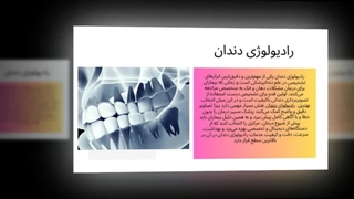 رادیولوژی دندان؛ تشخیص سریع، دقیق و تجربه‌ای بی‌نظیر برای سلامت لبخند شما! : نت جا