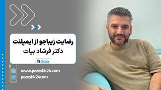 ایملپنت دندان با دکتر فرشاد بیات تهران - پزشک 24