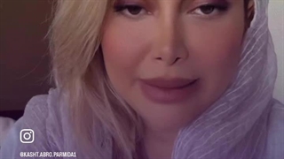 هزینه و قیمت کاشت ابرو در کرج