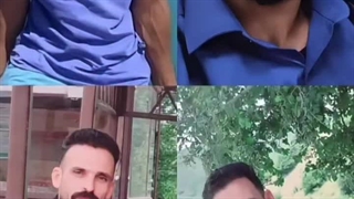 نمونه کاشت مو زیبا مهدی پور