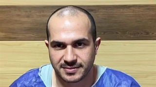 نتیجه کاشت مو خانم طهماسبی