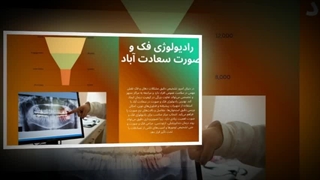 رادیولوژی فک و صورت سعادت‌آباد – دقت، سرعت و آرامش در تصویربرداری تخصصی: صنعتیان جا