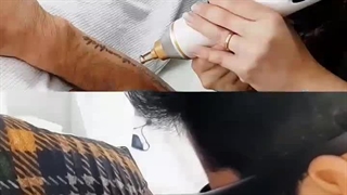 کلینیک زیبایی مه نگار-لیزر موهای زائد-لیزرتهرانپارس-کلینیک زیبایی تهرانپارس- پاک کردن تاتو- پاک کردن تاتو با لیزر -لیزرنارمک