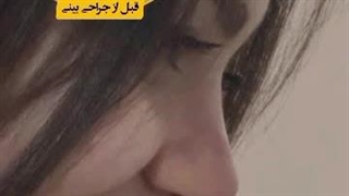 تصاویر ارسال از زیباجوی عزیز (2 سال پس از جراحی بینی)