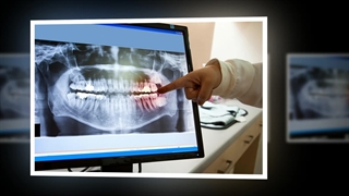 آشنایی با خدمات بهترین رادیولوژی دندان سعادت آباد: صنعتیان جا