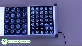 نگاتسکوپ چیست و چه کاربردی در تشخیص پزشکی دارد؟