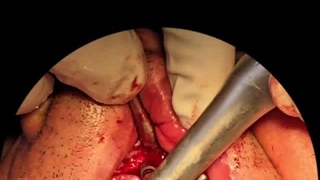 دندانپزشکی با بیهوشی عمومی در تهران توسط دکتر حمید پورصادقی