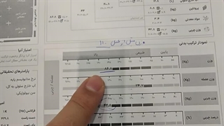 رضایت عمل جراحی لاغری | دکتر آذرپیکان