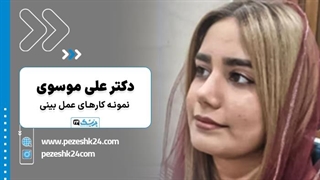 قبل و بعد عمل بینی در یزد- نمونه کارهای دکتر علی موسوی- پزشک 24