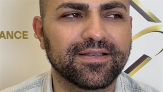کاشت مو با بالاترین تراکم