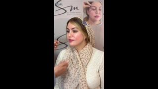 رضایت از سوپر لیفت صورت و گردن با زیبایی طبیعی