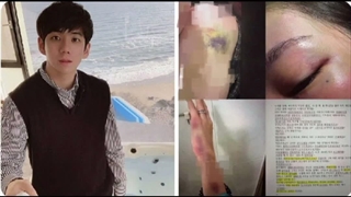 همسرِ برادر جیسو گفته که شوهرش برای مدت طولانی اون رو تحت کنترل شدید قرار داده و رفتارهایی داشته که به او آسیب رسانده. کپ
