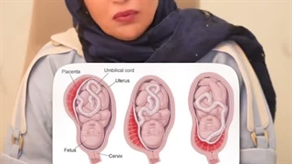 جفت سر راهه یعنی چی؟ آیا باید بترسیم؟
