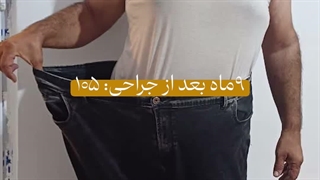 ۸۰ کیلو کاهش وزن در ۹ ماه!