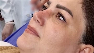 لیزر دکتر ادبی بابل